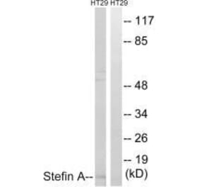 Western blot - Stefin A Antibody from Signalway Antibody (33489) - Antibodies.com