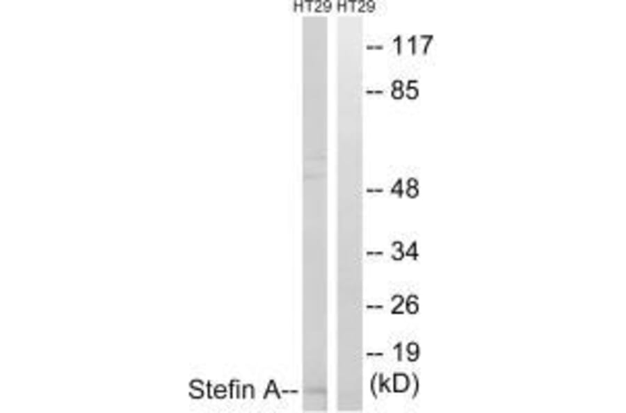 Western blot - Stefin A Antibody from Signalway Antibody (33489) - Antibodies.com