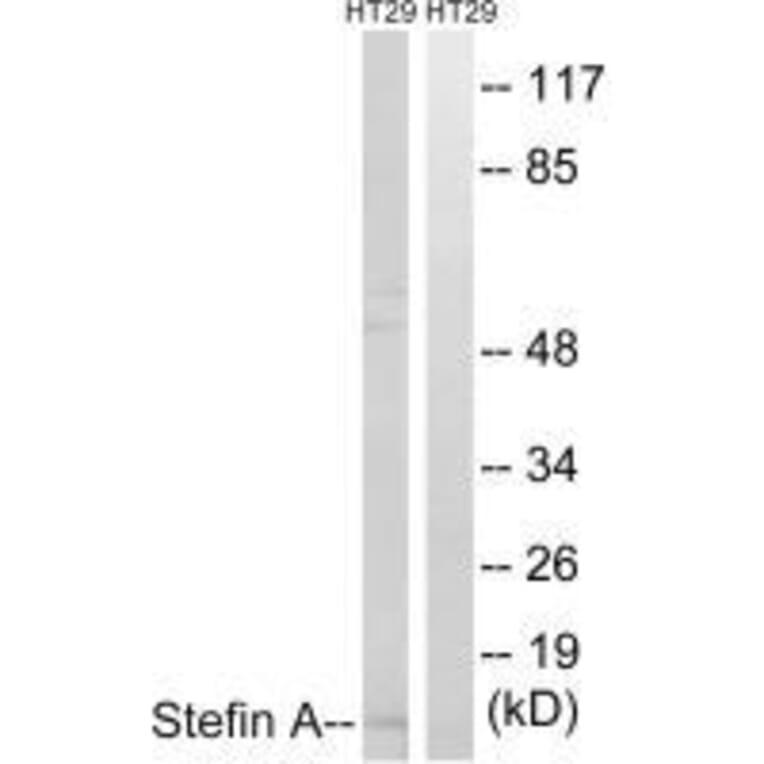 Western blot - Stefin A Antibody from Signalway Antibody (33489) - Antibodies.com