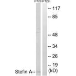 Western blot - Stefin A Antibody from Signalway Antibody (33489) - Antibodies.com