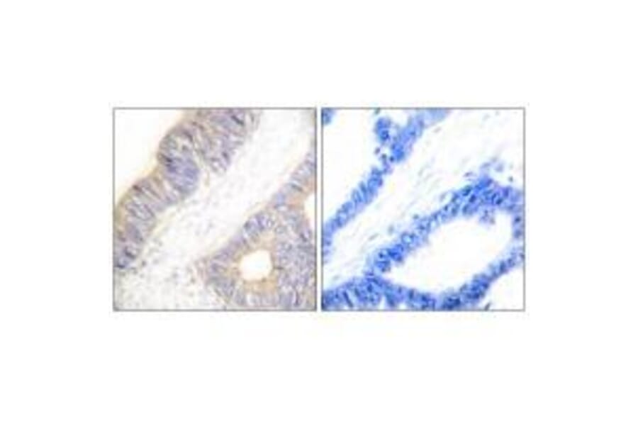 Immunohistochemistry - Stefin A Antibody from Signalway Antibody (33489) - Antibodies.com