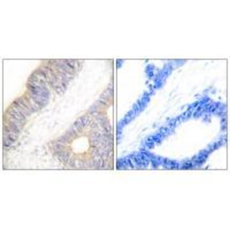 Immunohistochemistry - Stefin A Antibody from Signalway Antibody (33489) - Antibodies.com