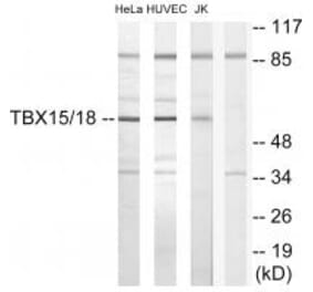 Western blot - TBX15/18 Antibody from Signalway Antibody (33639) - Antibodies.com
