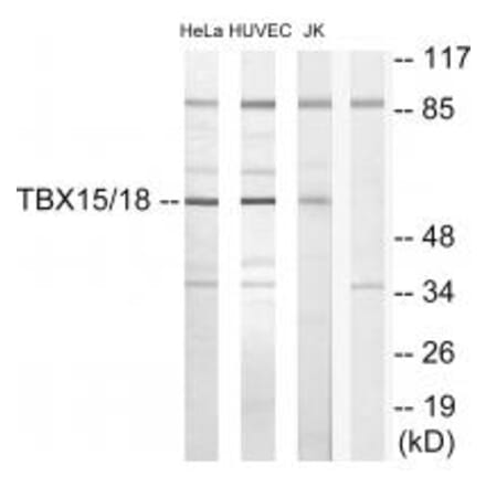 Western blot - TBX15/18 Antibody from Signalway Antibody (33639) - Antibodies.com