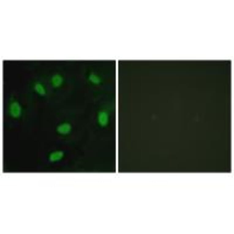 Immunofluorescence - TBX15/18 Antibody from Signalway Antibody (33639) - Antibodies.com