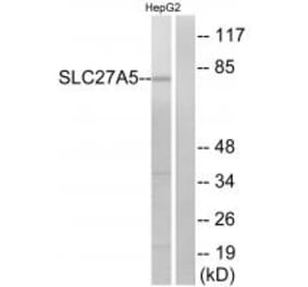 Western blot - SLC27A5 Antibody from Signalway Antibody (34498) - Antibodies.com