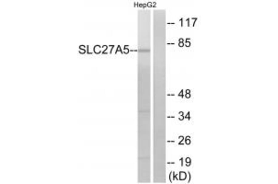Western blot - SLC27A5 Antibody from Signalway Antibody (34498) - Antibodies.com
