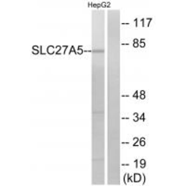 Western blot - SLC27A5 Antibody from Signalway Antibody (34498) - Antibodies.com