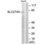 Western blot - SLC27A5 Antibody from Signalway Antibody (34498) - Antibodies.com