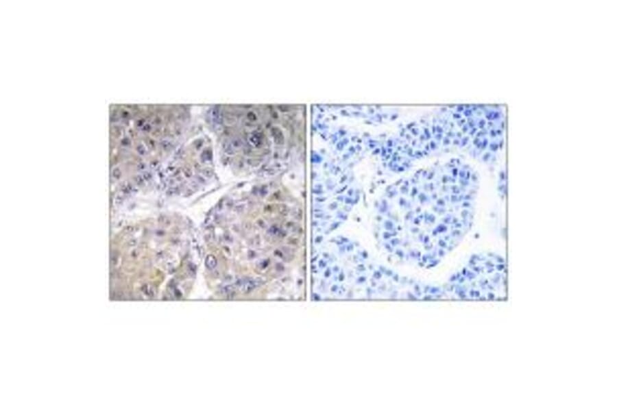 Immunohistochemistry - SLC27A5 Antibody from Signalway Antibody (34498) - Antibodies.com