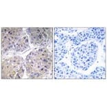 Immunohistochemistry - SLC27A5 Antibody from Signalway Antibody (34498) - Antibodies.com