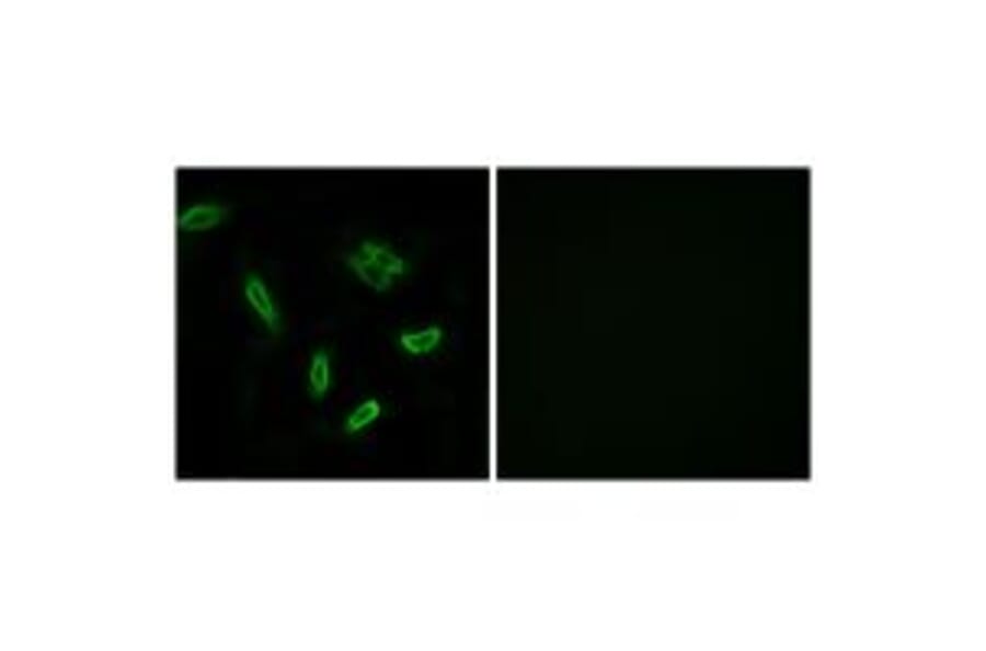 Immunofluorescence - SLC27A5 Antibody from Signalway Antibody (34498) - Antibodies.com