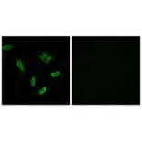 Immunofluorescence - SLC27A5 Antibody from Signalway Antibody (34498) - Antibodies.com