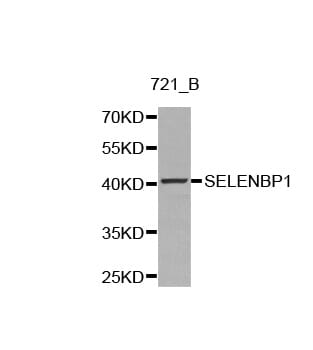 Western blot analysis of 721_B cell lysate using SELENBP1 antibody.