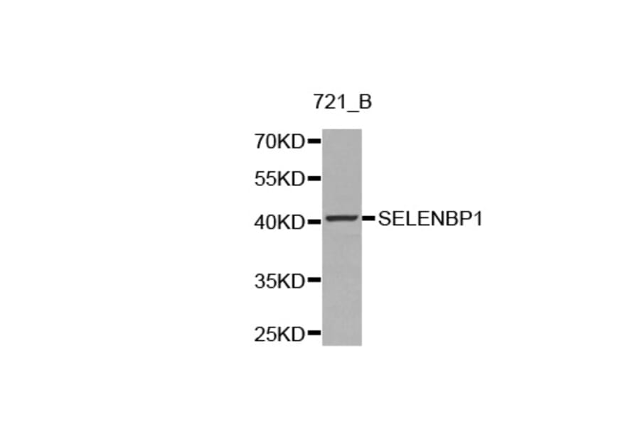 Western blot - SELENBP1 antibody from Signalway Antibody (38221) - Antibodies.com