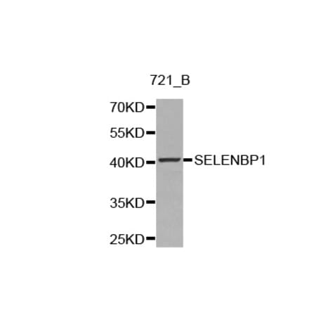 Western blot - SELENBP1 antibody from Signalway Antibody (38221) - Antibodies.com