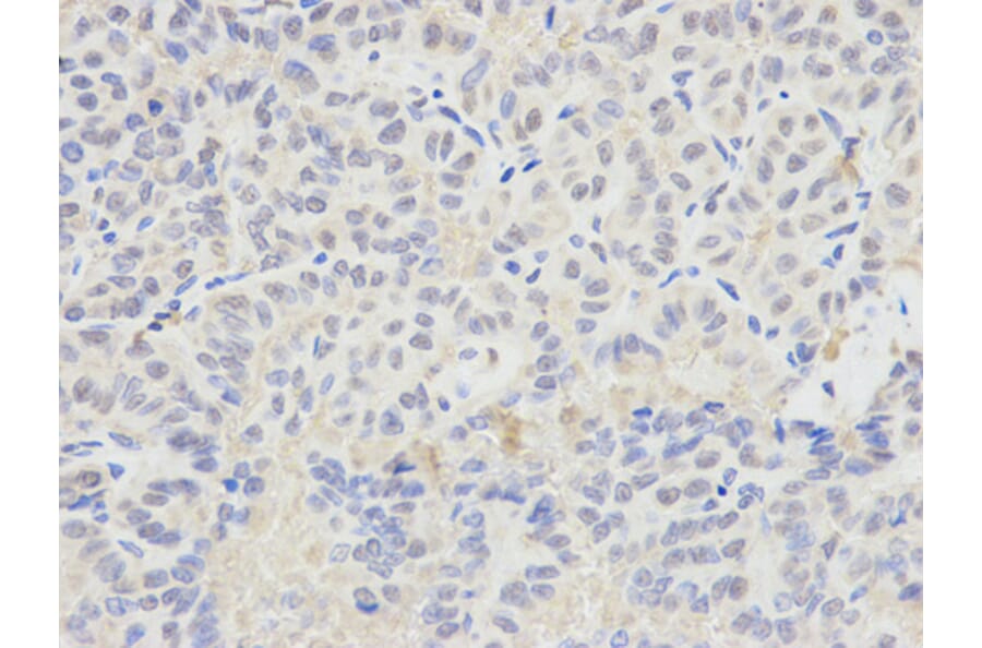 Immunohistochemistry - SELENBP1 antibody from Signalway Antibody (38221) - Antibodies.com
