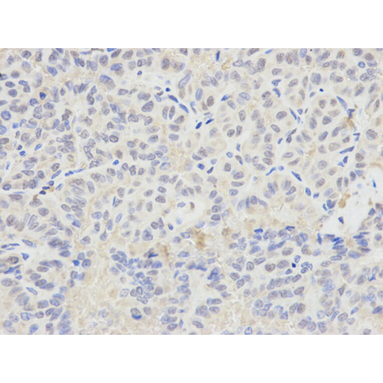 Immunohistochemistry - SELENBP1 antibody from Signalway Antibody (38221) - Antibodies.com