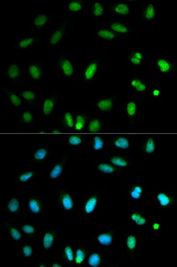Immunofluorescence analysis of HeLa cell using SELENBP1 antibody. Blue: DAPI for nuclear staining.