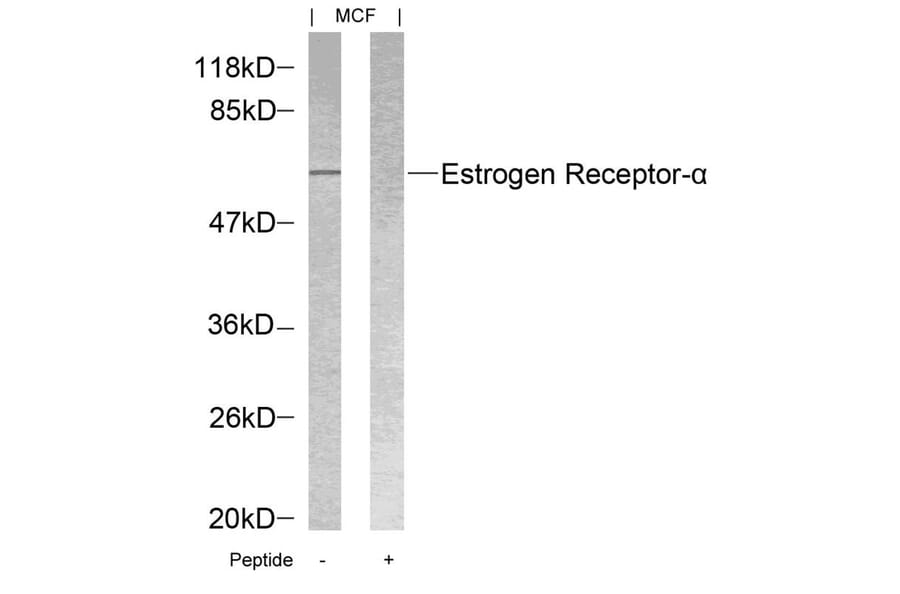 Western blot - Estrogen Receptor-a (Ab-118) Antibody from Signalway Antibody (21067) - Antibodies.com