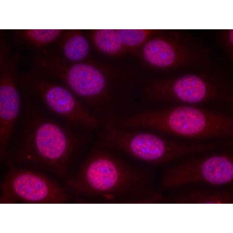 Immunofluorescence - Estrogen Receptor-a (Ab-118) Antibody from Signalway Antibody (21067) - Antibodies.com