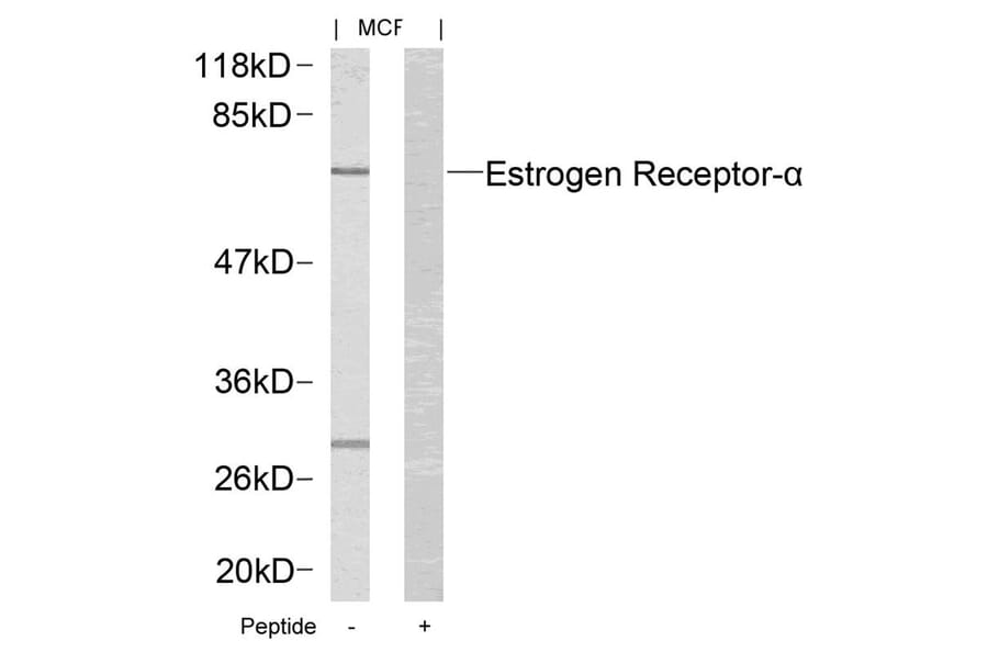 Western blot - Estrogen Receptor-a (Ab-167) Antibody from Signalway Antibody (21068) - Antibodies.com