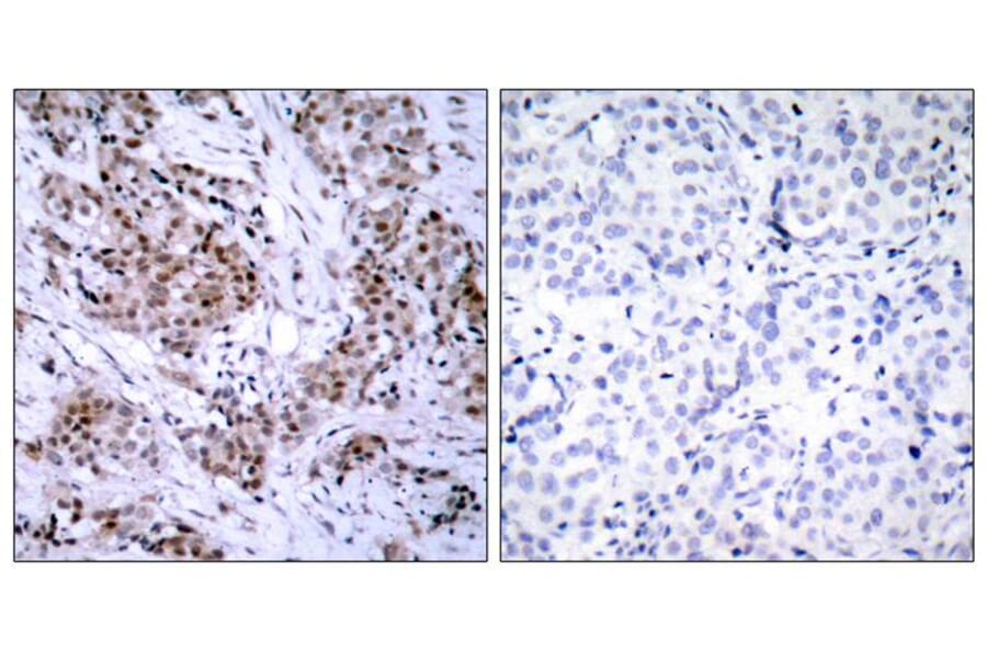 Immunohistochemistry - Estrogen Receptor-a (Ab-167) Antibody from Signalway Antibody (21068) - Antibodies.com