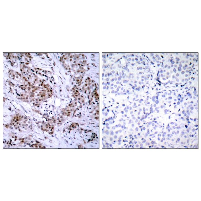 Immunohistochemistry - Estrogen Receptor-a (Ab-167) Antibody from Signalway Antibody (21068) - Antibodies.com