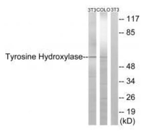 Western blot - Tyrosine Hydroxylase (Ab-19) Antibody from Signalway Antibody (33120) - Antibodies.com