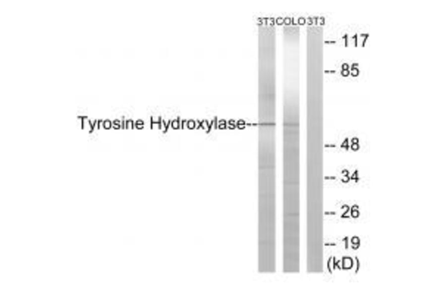 Western blot - Tyrosine Hydroxylase (Ab-19) Antibody from Signalway Antibody (33120) - Antibodies.com