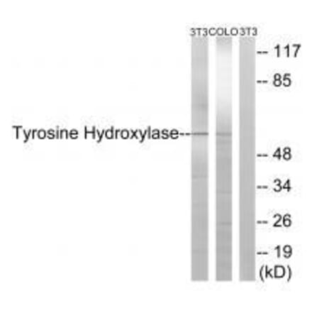 Western blot - Tyrosine Hydroxylase (Ab-19) Antibody from Signalway Antibody (33120) - Antibodies.com