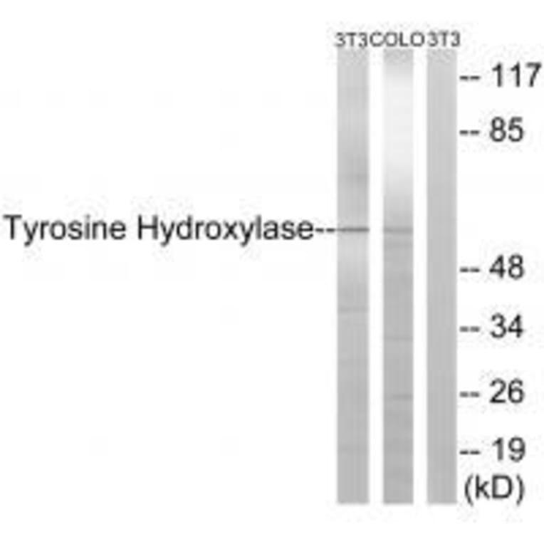 Western blot - Tyrosine Hydroxylase (Ab-19) Antibody from Signalway Antibody (33120) - Antibodies.com
