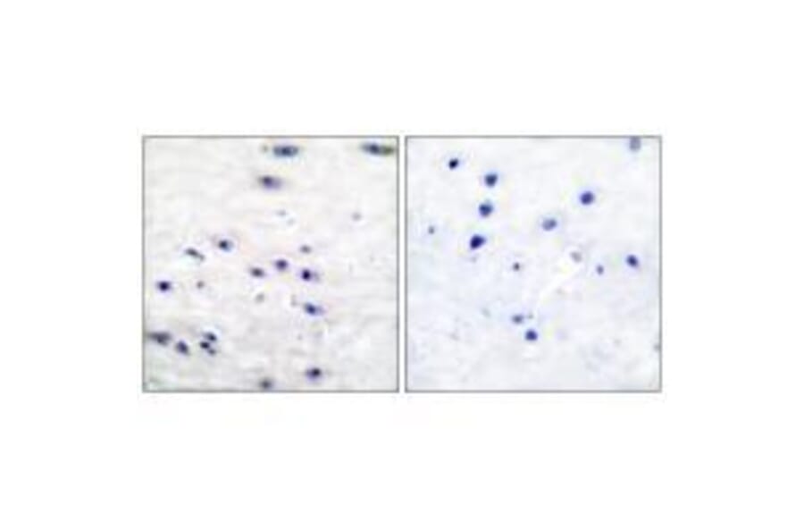 Immunohistochemistry - Tyrosine Hydroxylase (Ab-19) Antibody from Signalway Antibody (33120) - Antibodies.com