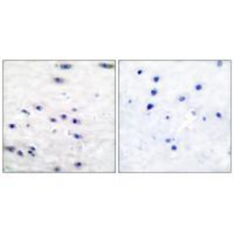 Immunohistochemistry - Tyrosine Hydroxylase (Ab-19) Antibody from Signalway Antibody (33120) - Antibodies.com