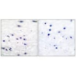 Immunohistochemistry - Tyrosine Hydroxylase (Ab-19) Antibody from Signalway Antibody (33120) - Antibodies.com