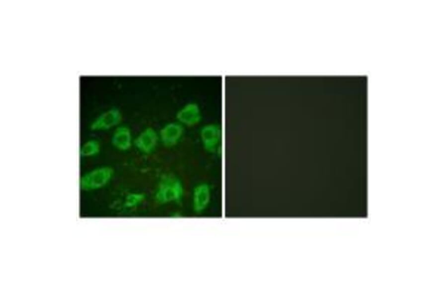 Immunofluorescence - Tyrosine Hydroxylase (Ab-19) Antibody from Signalway Antibody (33120) - Antibodies.com