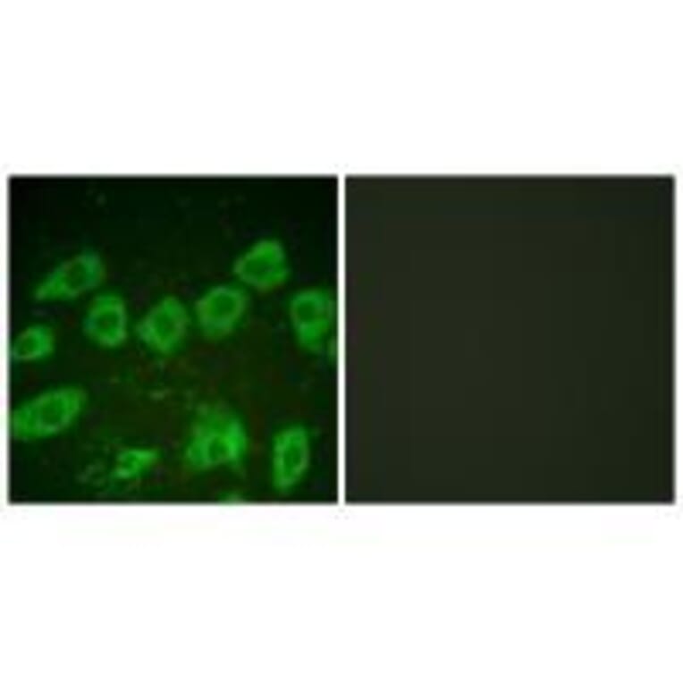 Immunofluorescence - Tyrosine Hydroxylase (Ab-19) Antibody from Signalway Antibody (33120) - Antibodies.com
