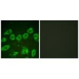 Immunofluorescence - Tyrosine Hydroxylase (Ab-19) Antibody from Signalway Antibody (33120) - Antibodies.com