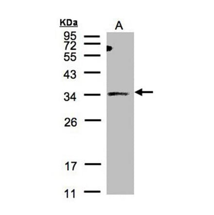ST3GAL1 antibody from Signalway Antibody (22094) - Antibodies.com