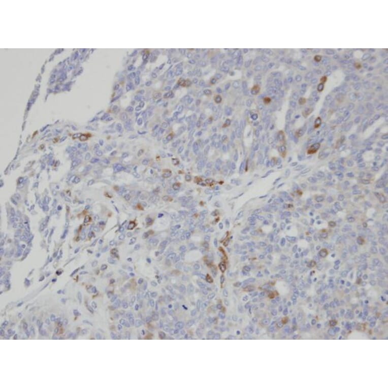 Immunohistochemistry - ST3GAL1 antibody from Signalway Antibody (22094) - Antibodies.com