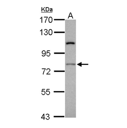 RASGRP4 antibody from Signalway Antibody (22219) - Antibodies.com
