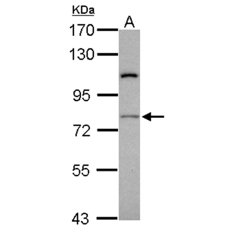 RASGRP4 antibody from Signalway Antibody (22219) - Antibodies.com