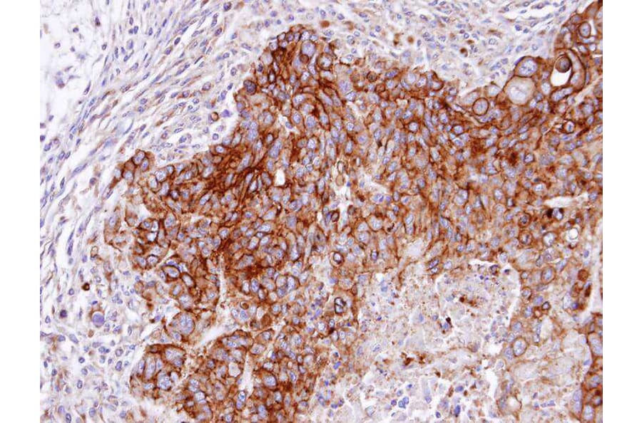 Immunohistochemistry - RASGRP4 antibody from Signalway Antibody (22219) - Antibodies.com