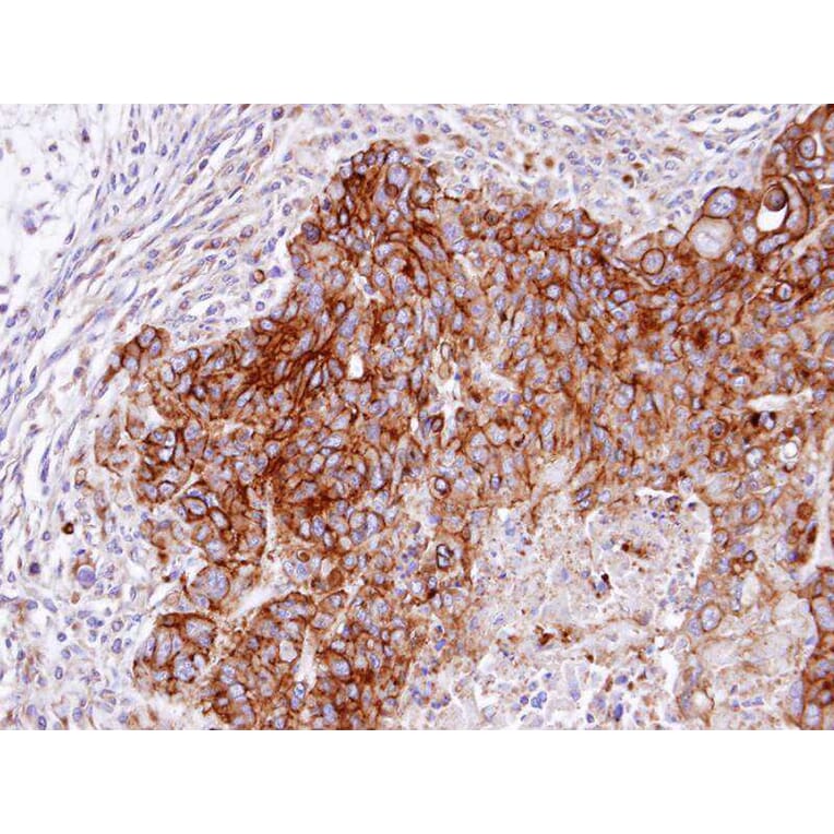 Immunohistochemistry - RASGRP4 antibody from Signalway Antibody (22219) - Antibodies.com