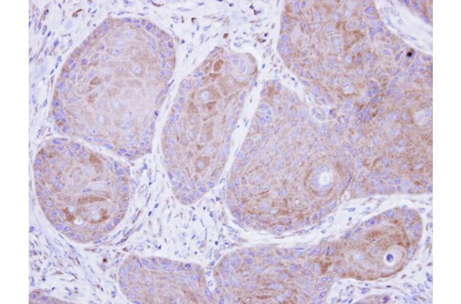 Immunohistochemistry - POMGNT1 antibody from Signalway Antibody (22230) - Antibodies.com