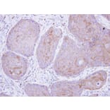 Immunohistochemistry - POMGNT1 antibody from Signalway Antibody (22230) - Antibodies.com