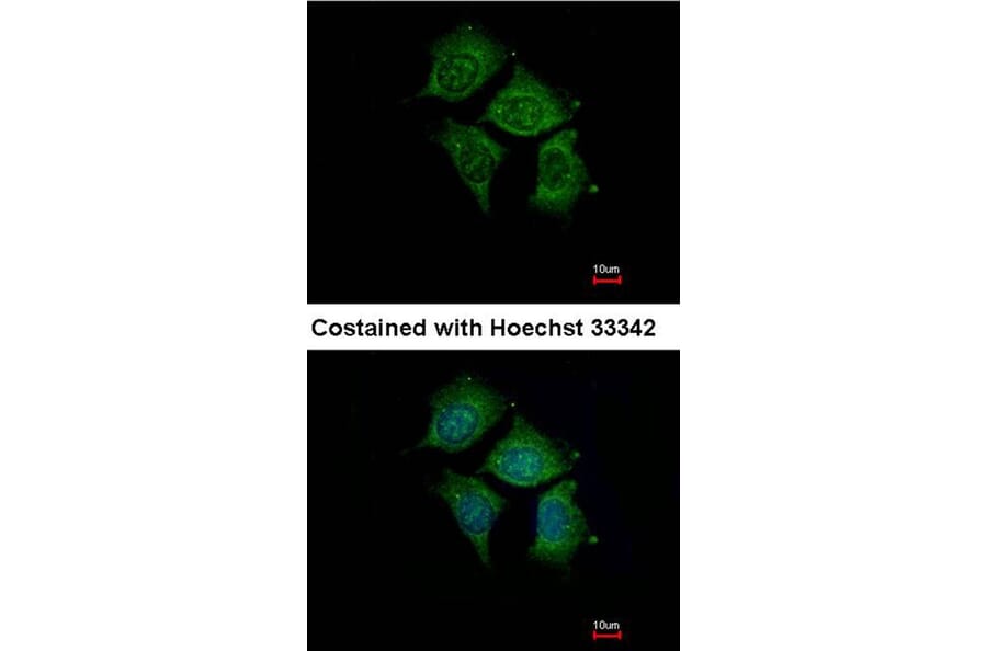 Immunofluorescence - POMGNT1 antibody from Signalway Antibody (22230) - Antibodies.com
