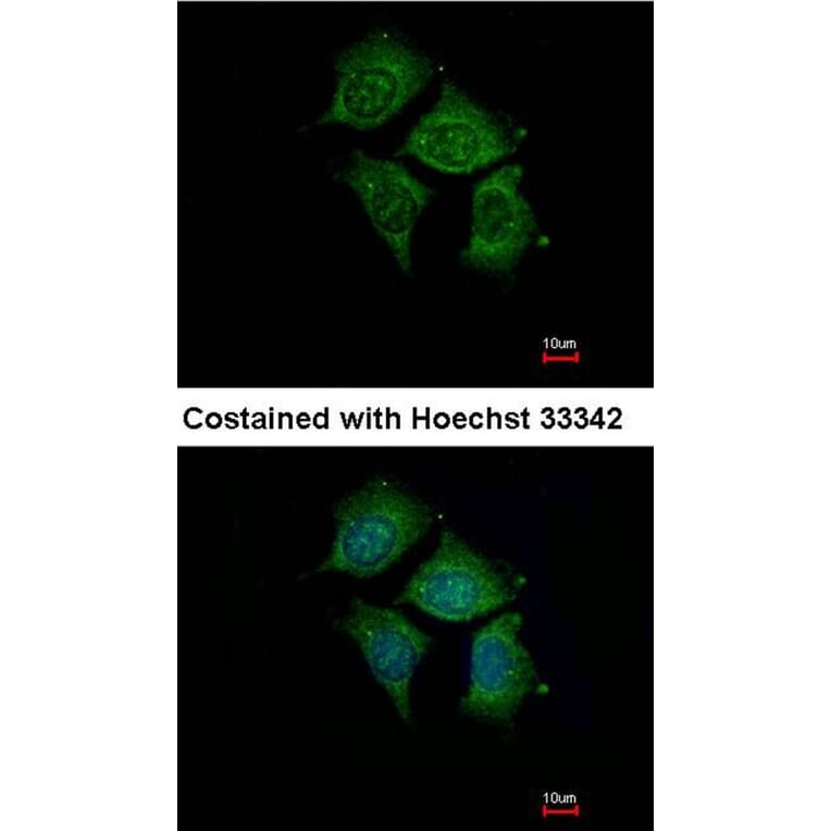Immunofluorescence - POMGNT1 antibody from Signalway Antibody (22230) - Antibodies.com