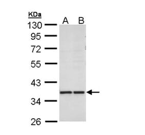 AKR1B10 antibody from Signalway Antibody (22305) - Antibodies.com