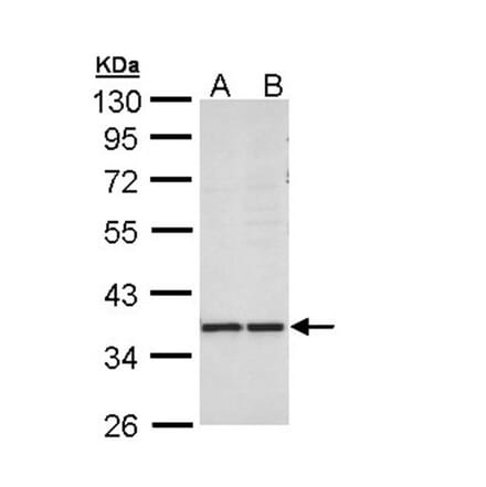 AKR1B10 antibody from Signalway Antibody (22305) - Antibodies.com